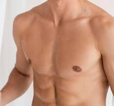 ftm-top-surgery